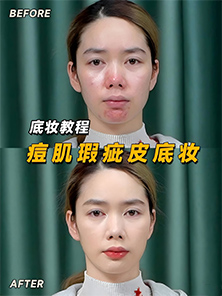 化妆教程 | 痘痘肌瑕疵皮也能拥有磨皮底妆